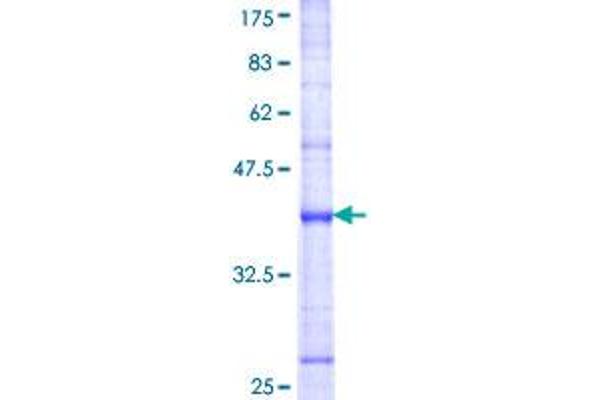 DUSP8 Protein (AA 2-109) (GST tag)