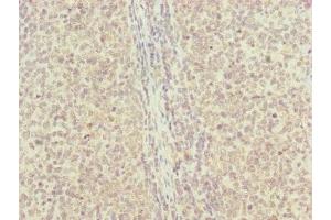 Immunohistochemistry of paraffin-embedded human tonsil tissue using ABIN7151143 at dilution of 1:100 (RNF13 抗体  (AA 204-381))
