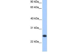 WB Suggested Anti-C12orf68 Antibody Titration: 0. (C12ORF68 抗体  (Middle Region))
