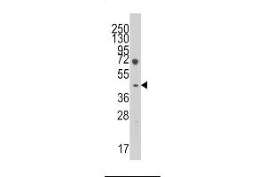 Western blot analysis of anti-LEFTB Pab in HL60 cell line lysates (35ug/lane). (LEFTY1 抗体  (C-Term))