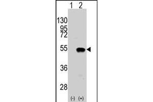 Western blot analysis of SYMD2 (arrow) using rabbit SMYD2 polyclonal antibody . (SMYD2A 抗体  (N-Term))