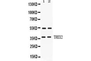 Western blot analysis of TREX2 expression in HELA whole cell lysates ( Lane 1) and MCF-7 whole cell lysates ( Lane 2). (TREX2 抗体  (AA 69-279))