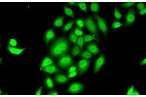 Immunofluorescence analysis of MCF7 cells using SPDEF Polyclonal Antibody (SPDEF/PSE 抗体)