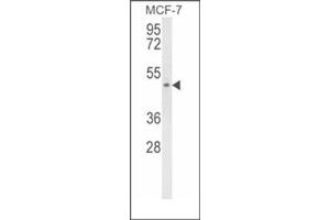 Western blot analysis of SCD5 Antibody (Center) Cat. (SCD5 抗体  (Middle Region))