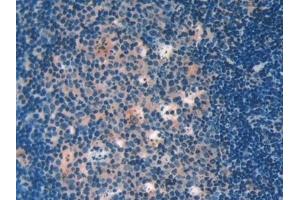 Detection of GAL9 in Mouse Lymph node Tissue using Polyclonal Antibody to Galectin 9 (GAL9) (Galectin 9 抗体  (AA 225-353))
