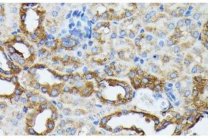 Immunohistochemistry of paraffin-embedded Mouse kidney using KRT14 Polyclonal Antibody at dilution of 1:100 (40x lens). (KRT14 抗体)