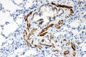 Immunohistochemistry (IHC) image for anti-ATPase, Ca++ Transporting, Cardiac Muscle, Slow Twitch 2 (ATP2A2) (N-Term) antibody (ABIN3030067)