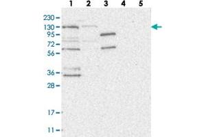 Western blot analysis of Lane 1: RT-4, Lane 2: U-251 MG, Lane 3: Human Plasma, Lane 4: Liver, Lane 5: Tonsil with HEATR6 polyclonal antibody . (HEATR6 抗体)
