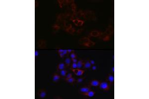 Immunofluorescence analysis of HepG2 cells using ApoB Rabbit pAb (ABIN3015447, ABIN3015448, ABIN5663872 and ABIN6217244) at dilution of 1:50 (40x lens). (APOB 抗体  (AA 28-330))