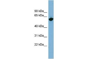 WB Suggested Anti-GPNMB Antibody Titration:  0. (Osteoactivin 抗体  (N-Term))