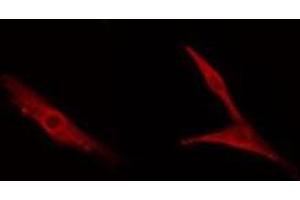 ABIN6278590 staining NIH-3T3 cells by IF/ICC. (MDM1 抗体  (Internal Region))