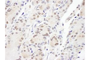 anti-Achalasia, Adrenocortical Insufficiency, Alacrimia (AAAS) (AA 496-546) antibody