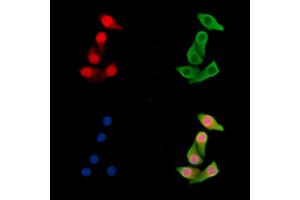 ABIN7095488 and ABIN7099545 staining Hela cells by IF/ICC. (UBXN7 抗体)