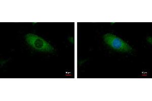 ICC/IF Image BCAR1 antibody [N2C2], Internal detects BCAR1 protein at cytoplasm by immunofluorescent analysis. (BCAR1 抗体  (Internal Region))
