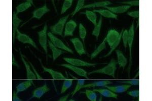 Immunofluorescence (IF) image for anti-Kinesin Family Member 14 (KIF14) antibody (ABIN7255237)