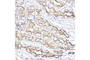 Immunohistochemistry of paraffin-embedded mouse kidney using Aquaporin-1  Rabbit pAb (ABIN7265651) at dilution of 1:100 (40x lens). (Aquaporin 1 抗体  (C-Term))