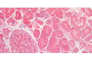 Immunohistochemistry (Paraffin-embedded Sections) (IHC (p)) image for anti-Spectrin alpha Chain, Brain (SPTAN1) antibody (ABIN7234066)