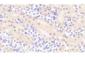Detection of CTH in Mouse Kidney Tissue using Polyclonal Antibody to Cystathionine (CTH) (Cystathionine (AA 14-224) 抗体)