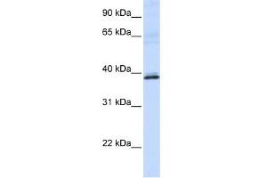 HAO2 antibody used at 1 ug/ml to detect target protein. (Hydroxyacid Oxidase 2 (HAO2) 抗体)