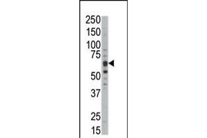 Western blot analysis of anti-DYRKB Pab in mouse kidney tissue lysate (DYRK1B 抗体  (C-Term))