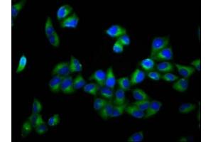 Immunofluorescence staining of Hela cells with ABIN7150052 at 1:166, counter-stained with DAPI. (ADAM29 抗体  (AA 701-820))