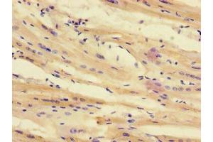 Immunohistochemistry of paraffin-embedded human heart tissue using ABIN7171701 at dilution of 1:100 (TTI1 抗体  (AA 692-858))