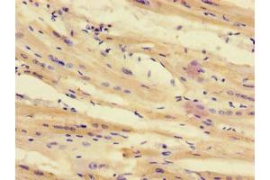 Immunohistochemistry of paraffin-embedded human heart tissue using ABIN7171701 at dilution of 1:100