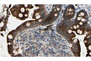 ABIN6269326 at 1/100 staining Mouse intestine tissue by IHC-P. (GRIN1/NMDAR1 抗体  (C-Term))