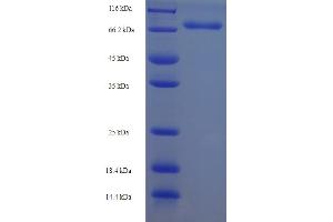 SDS-PAGE (SDS) image for Diphthamide Biosynthesis Protein 2 (DPH2) (AA 1-489), (full length) protein (His-SUMO Tag) (ABIN5711733)