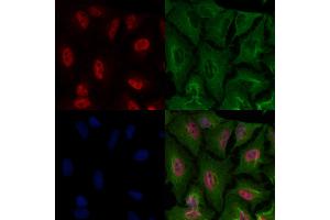 ABIN7093646 and ABIN7097672 staining  cells by IF/ICC. (HBP1 抗体)