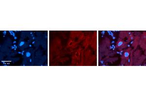 Rabbit Anti-SF1 Antibody   Formalin Fixed Paraffin Embedded Tissue: Human heart Tissue Observed Staining: Nucleus Primary Antibody Concentration: 1:100 Other Working Concentrations: N/A Secondary Antibody: Donkey anti-Rabbit-Cy3 Secondary Antibody Concentration: 1:200 Magnification: 20X Exposure Time: 0. (Splicing Factor 1 抗体  (Middle Region))