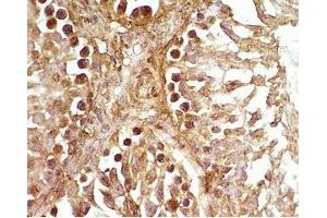 Rat testis tissue was stained by Rabbit Anti-Desnutrin (465-486) (Mouse) Serum (PNPLA2 抗体  (AA 465-486))