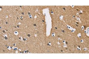 Immunohistochemistry of paraffin-embedded Human brain using PPP3CA Polyclonal Antibody at dilution of 1:40 (PPP3CA 抗体)