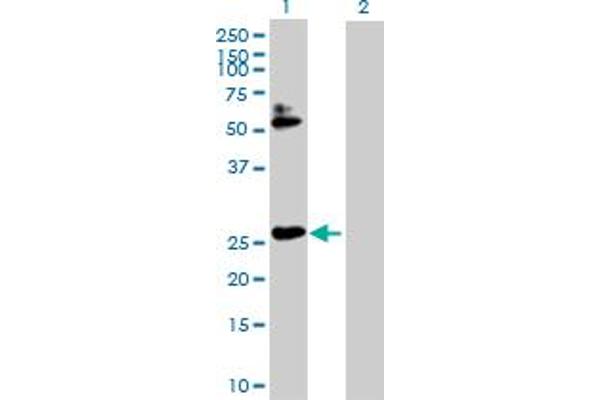 HOXB7 抗体  (AA 1-217)
