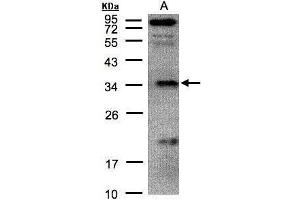 WB Image Sample(30 μg of whole cell lysate) A:H1299 12% SDS PAGE antibody diluted at 1:500 (FN3KRP 抗体)