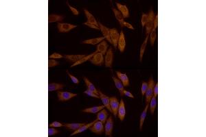 Immunofluorescence (IF) image for anti-Galectin 3 (LGALS3) antibody (ABIN7267337)