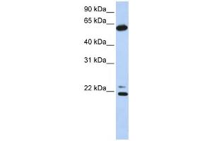 Western Blotting (WB) image for anti-Chaperonin Containing TCP1, Subunit 5 (Epsilon) (CCT5) antibody (ABIN2459816) (CCT5 抗体)