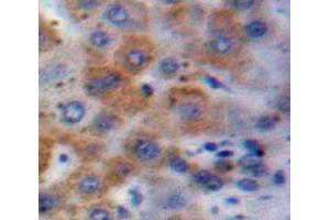 Used in DAB staining on fromalin fixed paraffin-embedded Liver tissue (GSTA1 抗体  (AA 2-222))