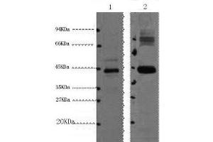 Western Blot analysis of 1) HepG2, 2) Mouse kidney using AMACR Monoclonal Antibody at dilution of 1:1000. (AMACR 抗体)