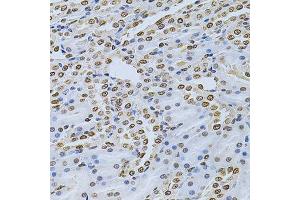 Immunohistochemistry of paraffin-embedded rat kidney using ILK Antibody. (ILK 抗体  (AA 1-260))