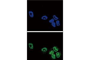 Confocal immunofluorescent analysis of PLA2G4A Antibody with NCI-H460 cell followed by Alexa Fluor488-conjugated goat anti-rabbit lgG (green). (PLA2G4A 抗体  (AA 513-541))