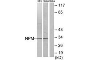 Western blot analysis of extracts from HeLa/NIH-3T3 cells, using NPM (Ab-234) Antibody. (NPM1 抗体  (AA 201-250))