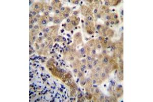 Immunohistochemistry analysis in formalin fixed and paraffin embedded human liver tissue reacted with LIN7C Antibdy (C-term) followed by peroxidase conjugation of the secondary antibody and DAB staining. (LIN7C 抗体  (C-Term))