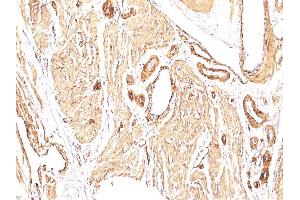 Immunohistochemistry (IHC) image for anti-Actin, alpha 2, Smooth Muscle, Aorta (ACTA2) (N-Term) antibody (ABIN6940518)