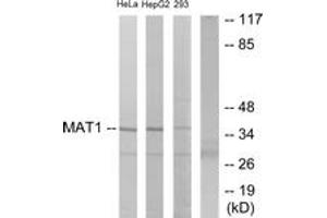 Western blot analysis of extracts from HeLa/HepG2/293 cells, using MAT1 Antibody. (MAT1A 抗体  (AA 91-140))