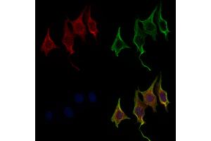 ABIN6266048 and ABIN6278957 staining 3 by IF/ICC.
