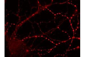 Immunocytochemistry on cultured hippocampus neurons (dilution 1 : 500). (Rab3c 抗体  (AA 154-227))