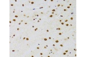 Immunohistochemistry of paraffin-embedded Rat brain using CSRP3 Polyclonal Antibody at dilution of 1:100 (40x lens). (CSRP3 抗体)