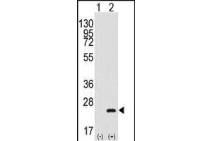 Western blot analysis of BarX1(arrow) using rabbit polyclonal BarX1 Antibody (C-term) (R). (BARX1 抗体  (AA 119-148))