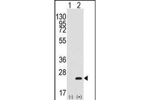Western blot analysis of BarX1(arrow) using rabbit polyclonal BarX1 Antibody (C-term) (R).